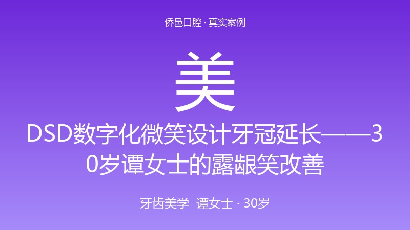 DSD数字化微笑设计牙冠延长——30岁谭女士的露龈笑改善 真实案例