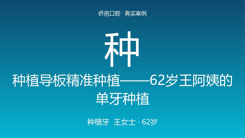 种植导板精准种植——62岁王阿姨的单牙种植